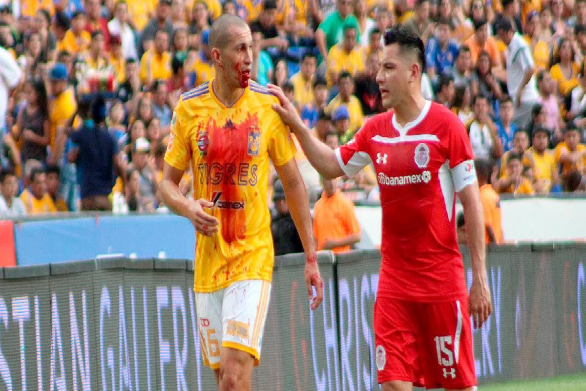 Tigres Torres Nilo Toluca Enrique Triverio Roberto García Orozco La cara fue al codo, no el codo a la cara No era ni amarilla